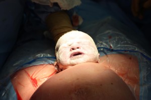 scarlett-cesarean